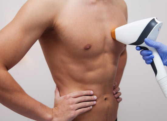 depilación laser corporal hombre
