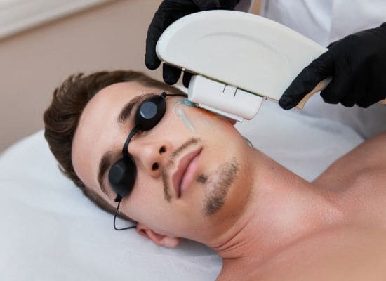 depilación laser facial hombre
