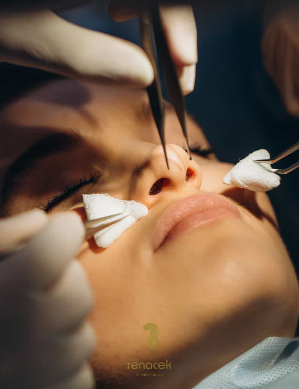 rinoplastia ultrasónica en Zaragoza