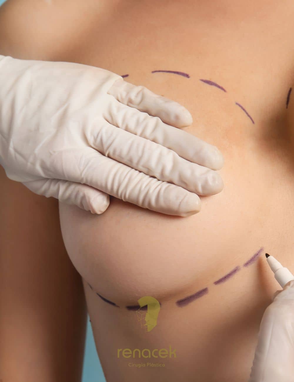 reducción de pecho precio zaragoza