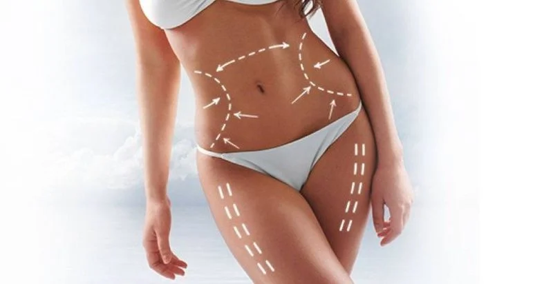Ventajas y desventajas de la Mesoterapia