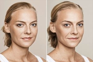 evitar el paso del tiempo