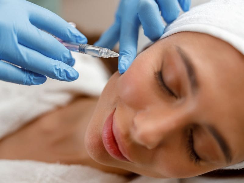 ventajas del Radiesse