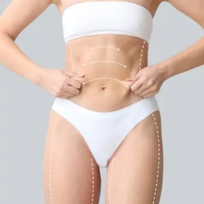 Liposucción