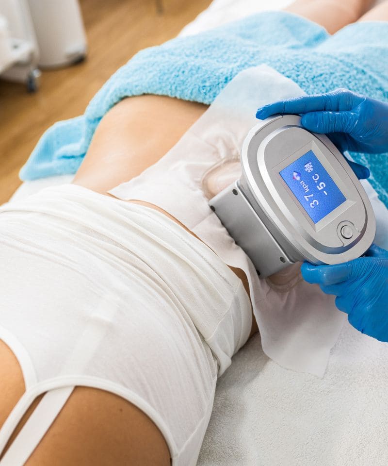 criolipolisis zaragoza