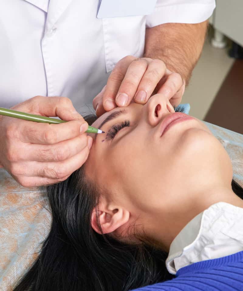 beneficios de la blefaroplastia