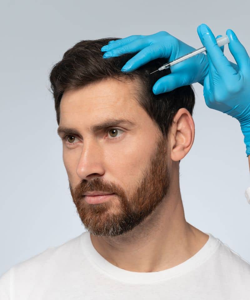 mesoterapia capilar zaragoza