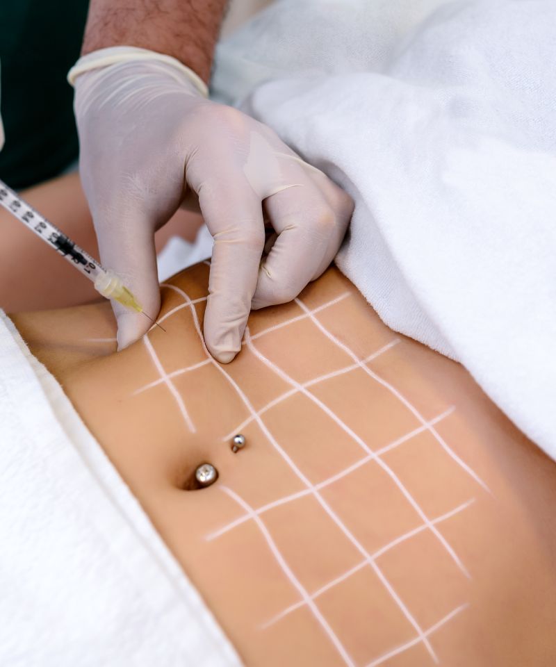 mesoterapia corporal zaragoza