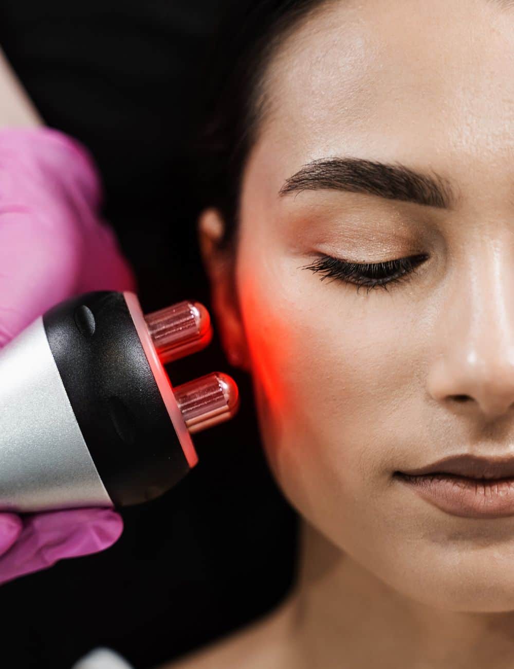 radiofrecuencia facial en zaragoza