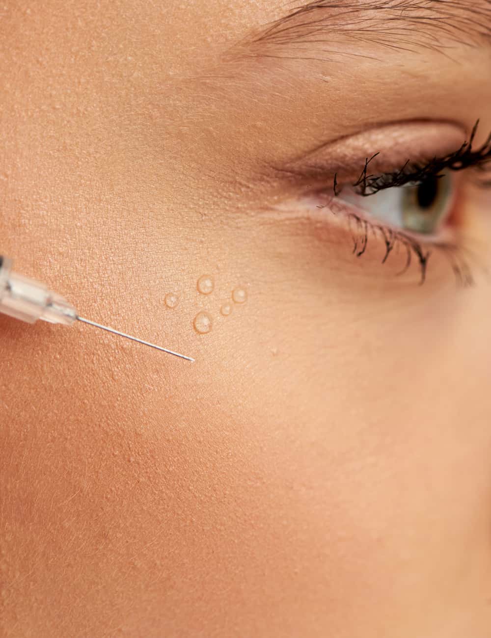 tratamiento restylane zaragoza