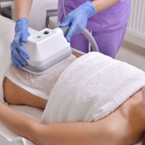 Criolipolisis que es