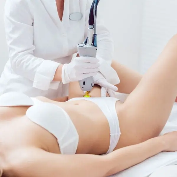 depilación laser