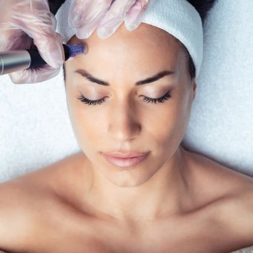 mesoterapia facial