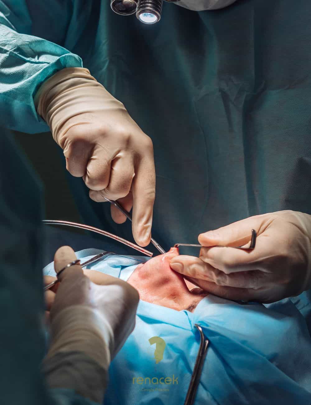 rinoplastia ultrasónica zaragoza