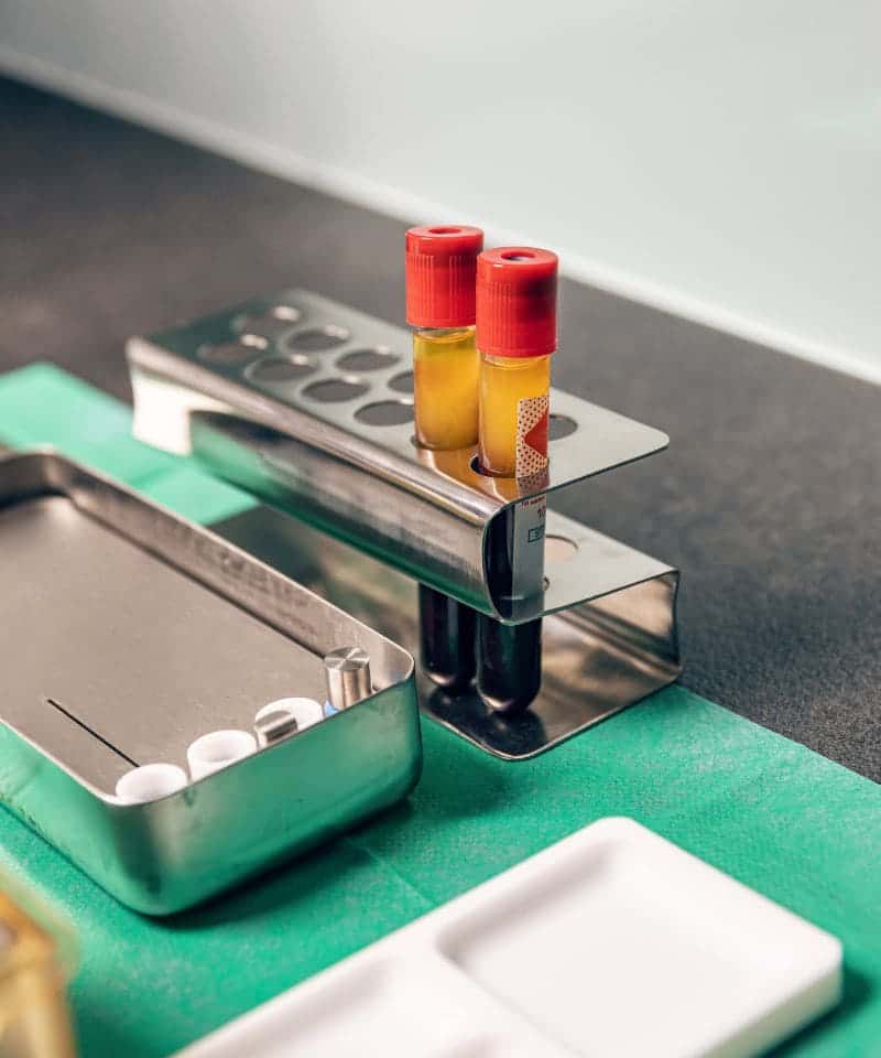 tratamiento prp capilar zaragoza