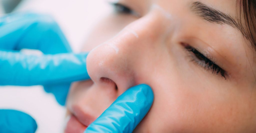 precio rinoplastia zaragoza