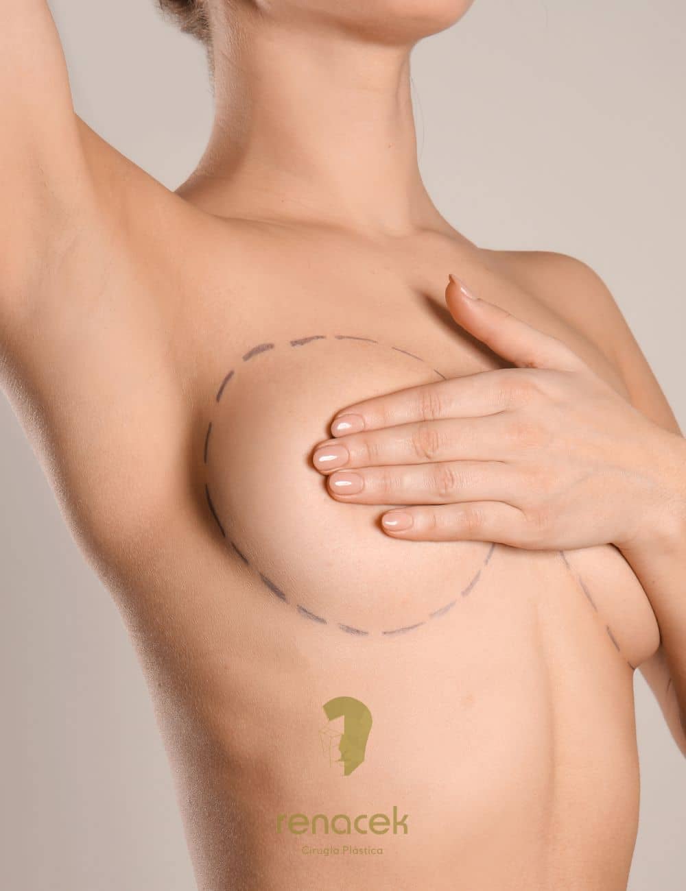 elevacion de pecho barcelona