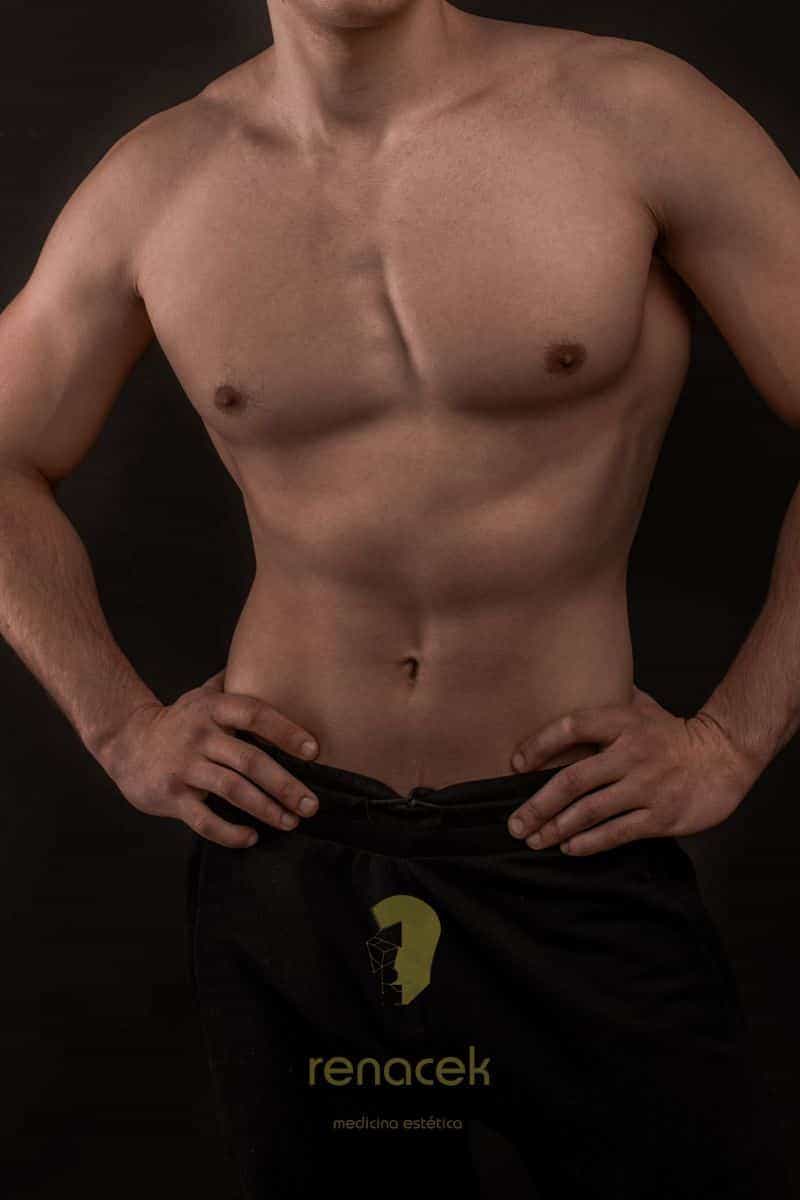 ginecomastia barcelona