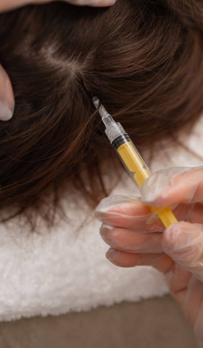 mesoterapia capilar en barcelona