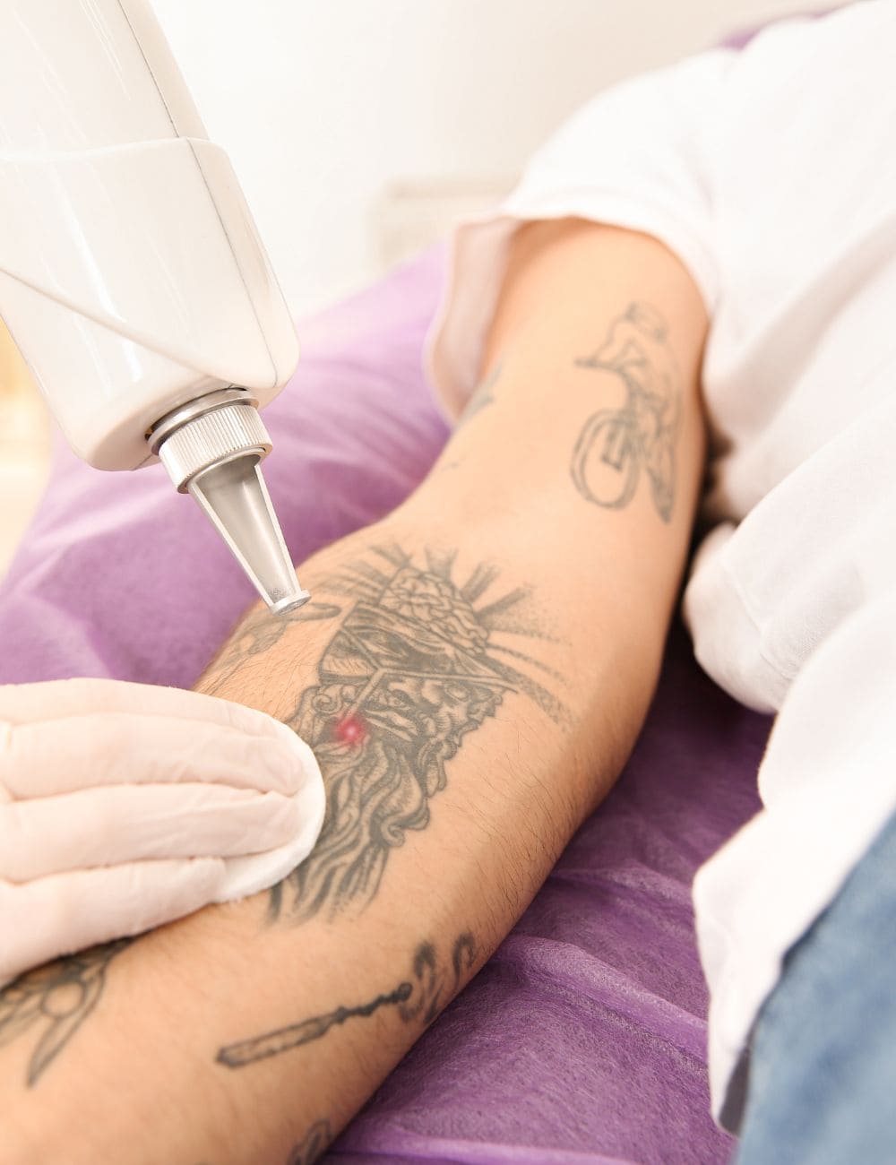 eliminar tatuajes zaragoza precio