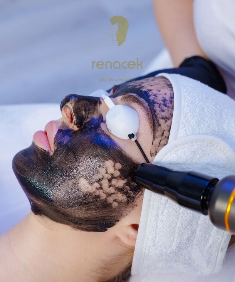 hollywood peel zaragoza