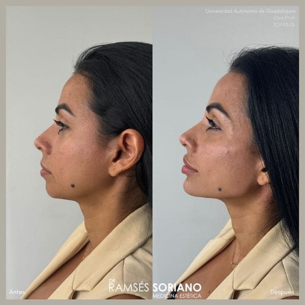 Curso Full Face + Russian Lips — formación en estética facial avanzada