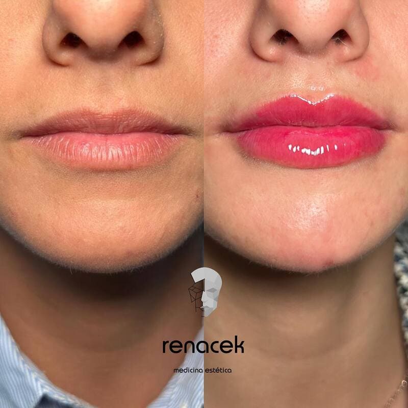 Casos clinicos del curso en Renacek Academy Zaragoza