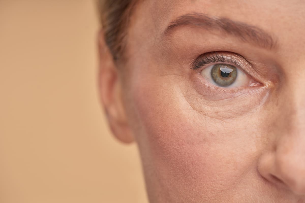 Tratamientos para eliminar las ojeras