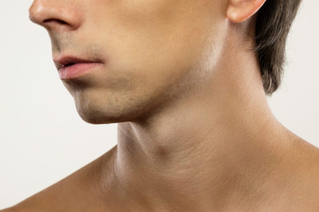 Marcación mandibular