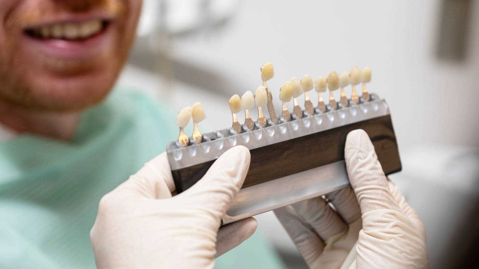 Guía de tonos dentales para elegir el color del diente