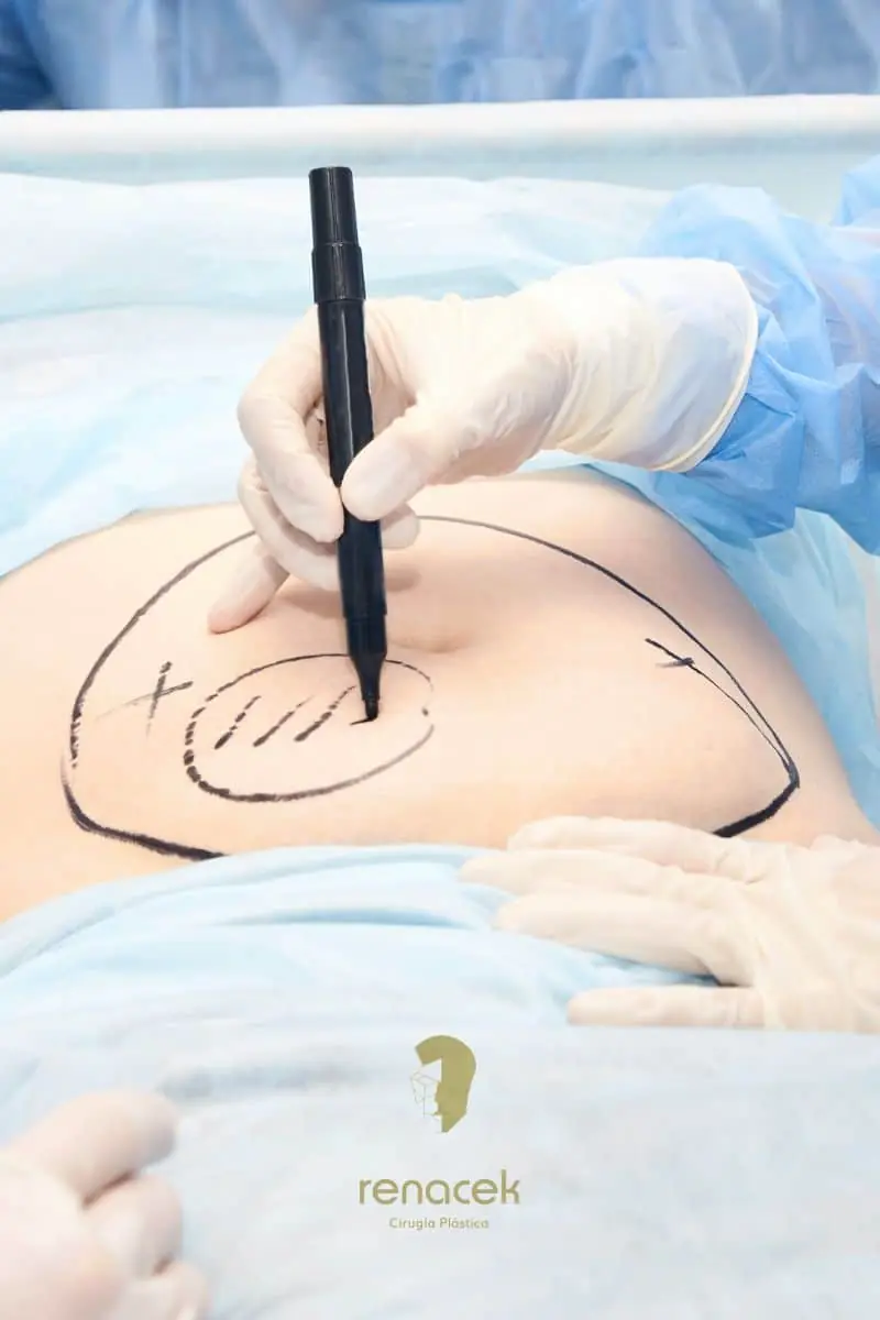 curso lipolaser españa online