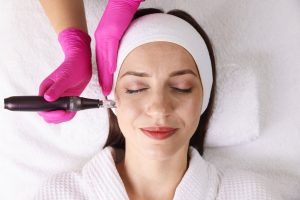 Sesión de dermapen: unas manos con guantes rosas acercan la pluma de microagujas a la mejilla de una paciente tumbada, vista desde arriba