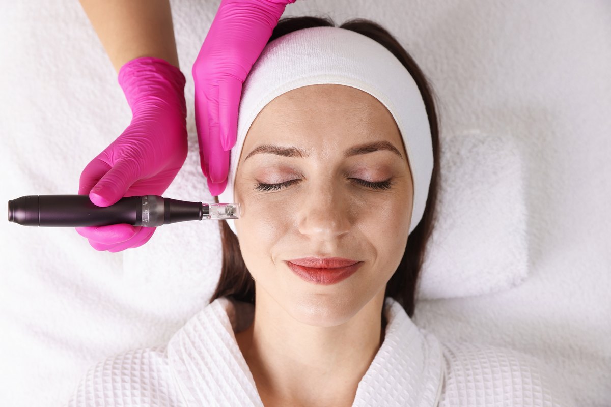 Sesión de dermapen: unas manos con guantes rosas acercan la pluma de microagujas a la mejilla de una paciente tumbada, vista desde arriba