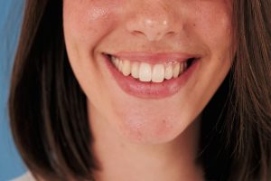Primer plano de la sonrisa de una mujer joven, con los labios entreabiertos y los dientes superiores a la vista