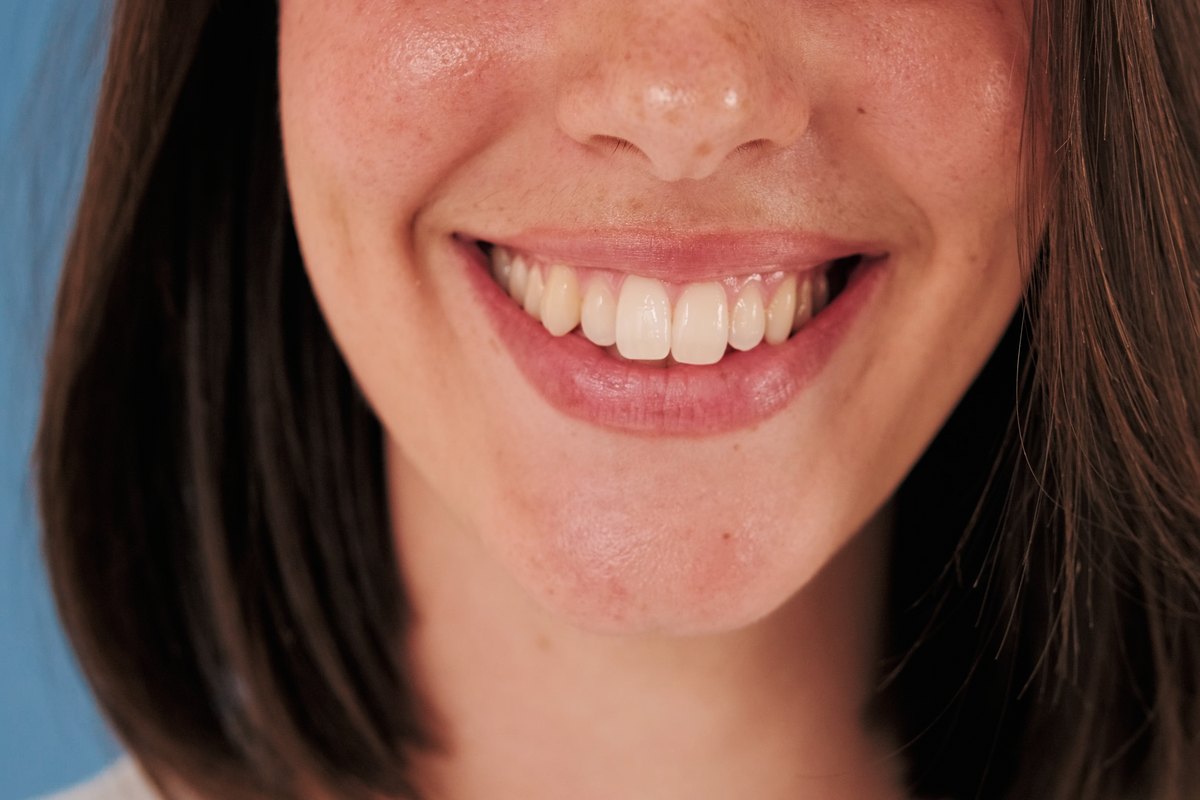 Primer plano de la sonrisa de una mujer joven, con los labios entreabiertos y los dientes superiores a la vista